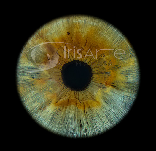IrisArte Fotografía del Iris en Madrid